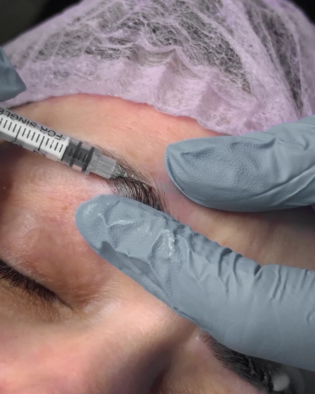 Preparing the application, with single use material beside the eyebrow.